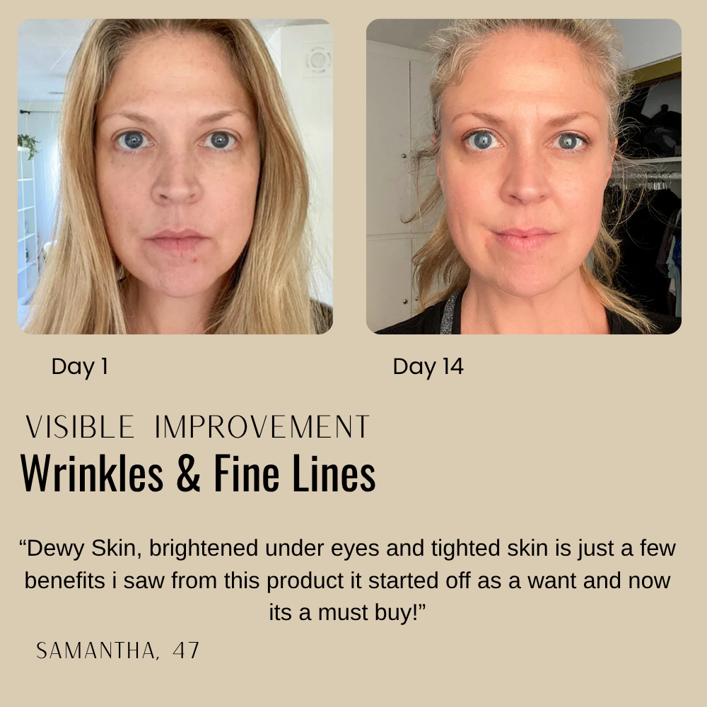 Nature's Fix™ - Peptide Neck & Chest Tightening Cream