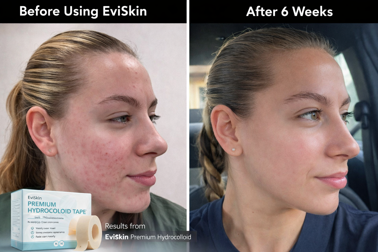 ClearLuxe™ Rapid Repair — Clear Skin Confidence That Turns Heads Every Time