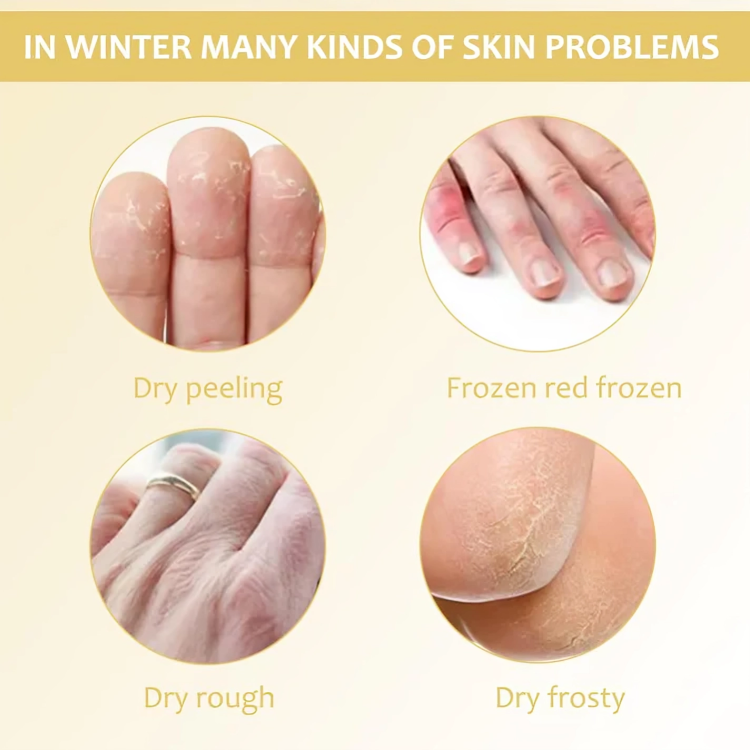 HydraVeil™ — Transform Your Dry, Cracked Skin Into Silky, Nourished Comfort