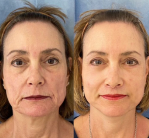 RejuviSkin™ — Unleash Radiant, Youthful Glow That Turns Heads Instantly