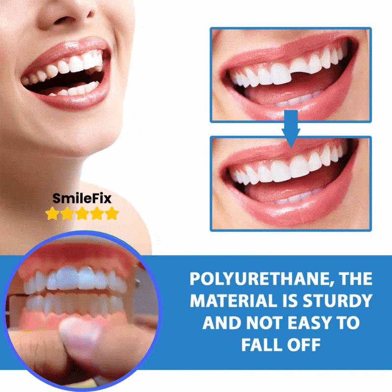 InstantSmile™ — Confidently Fill Gaps and Shine Bright Anywhere, Anytime