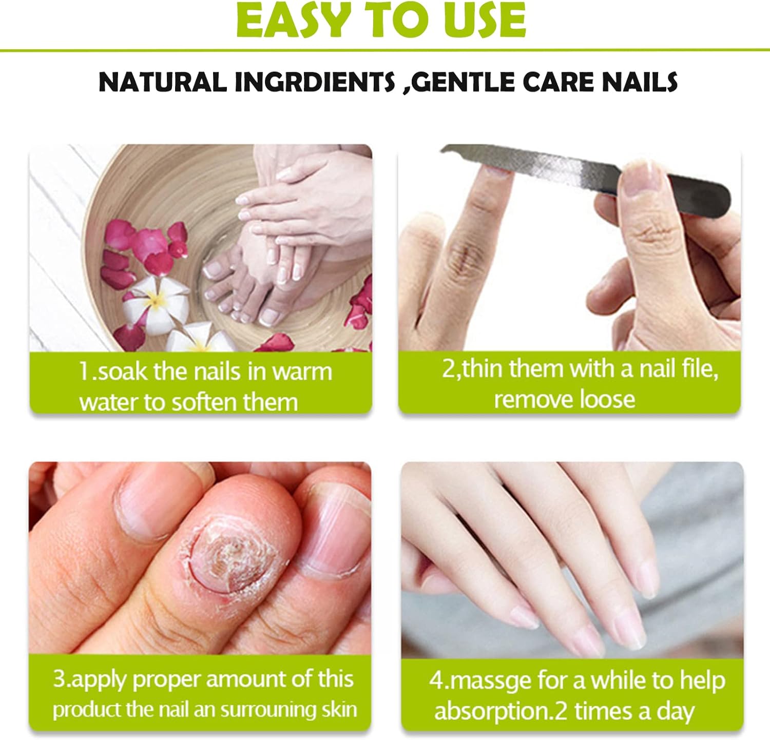 RadiantNail™ — Unlock Naturally Strong, Stunning Nails You’ll Love to Show Off