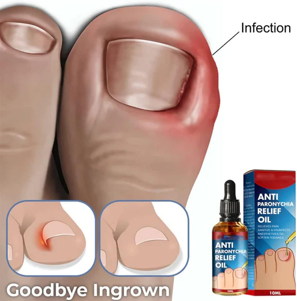 NailCure™ — Unleash Stunningly Strong Nails That Command Attention in Just Weeks