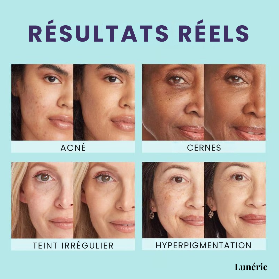 Ramelisse™ — Unlock All-Day Radiance and Effortless Confidence