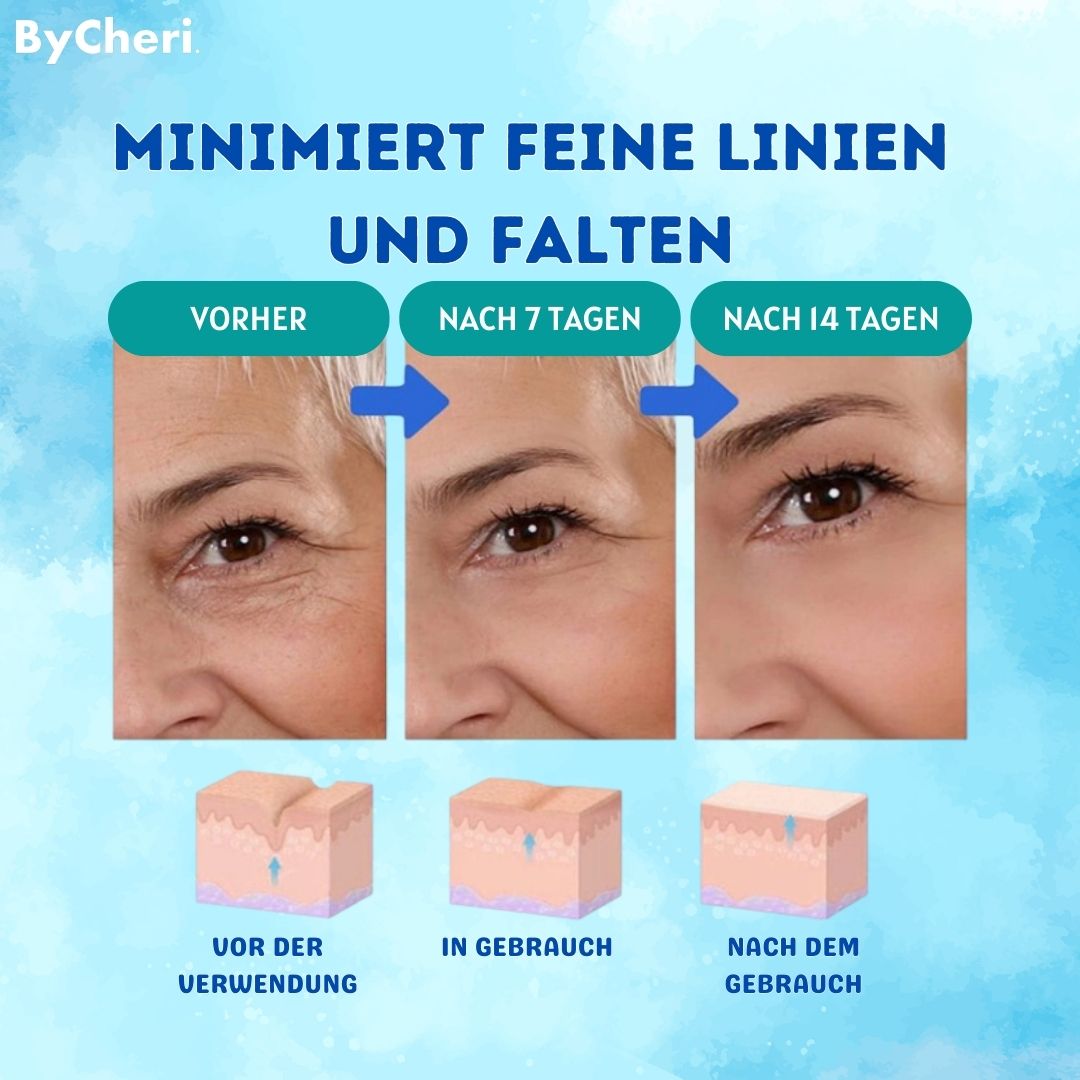 VivaLuxe™ — Unlock Youthful Radiance and Ditch Wrinkles Without Pain or Needles