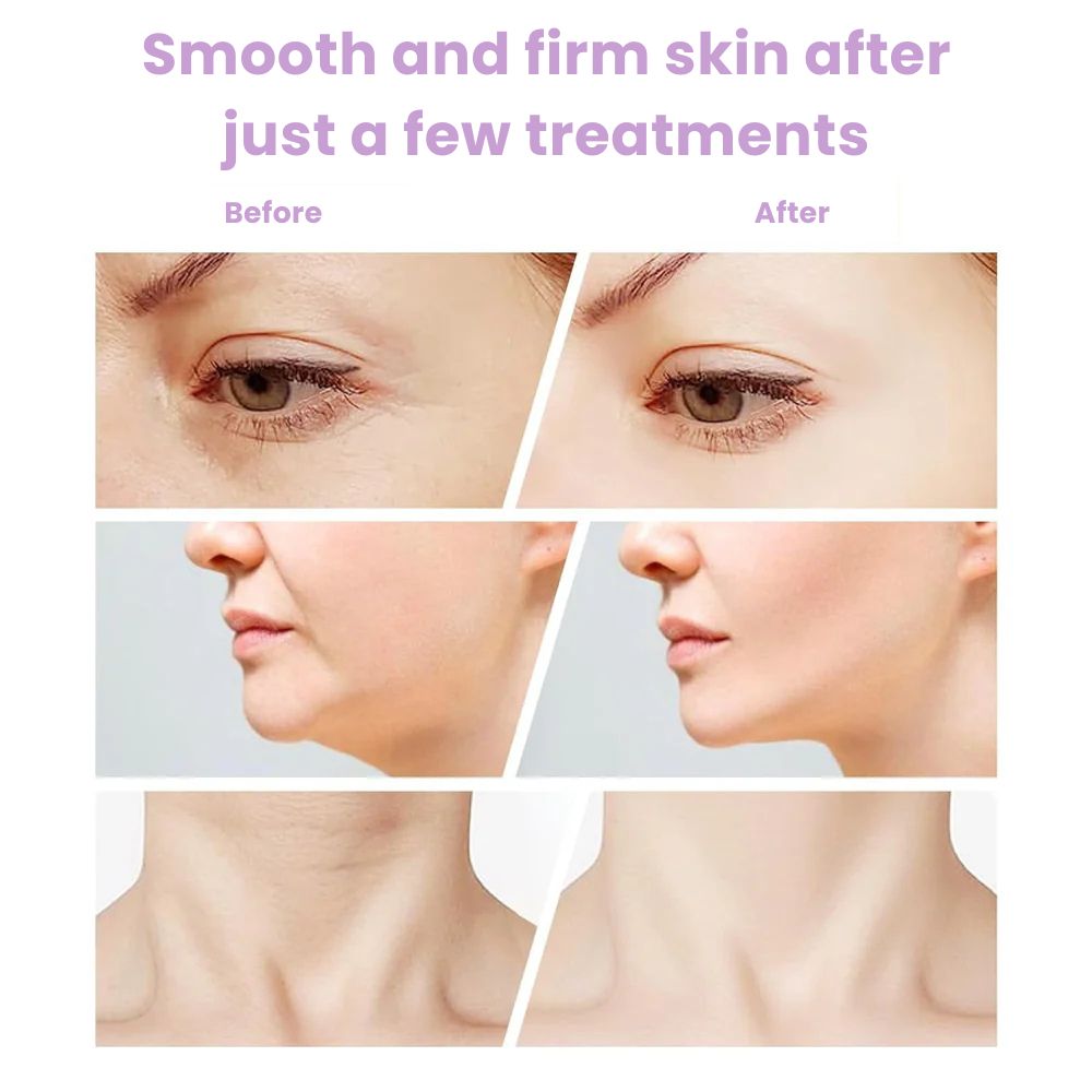 MaxReju© Anti-Wrinkle Neck-Facial Rejuvenating Massager