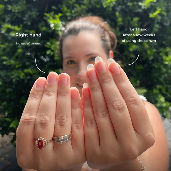 VelaNail™ — Transform Your Nails into Strong, Radiant Confidence Boosters