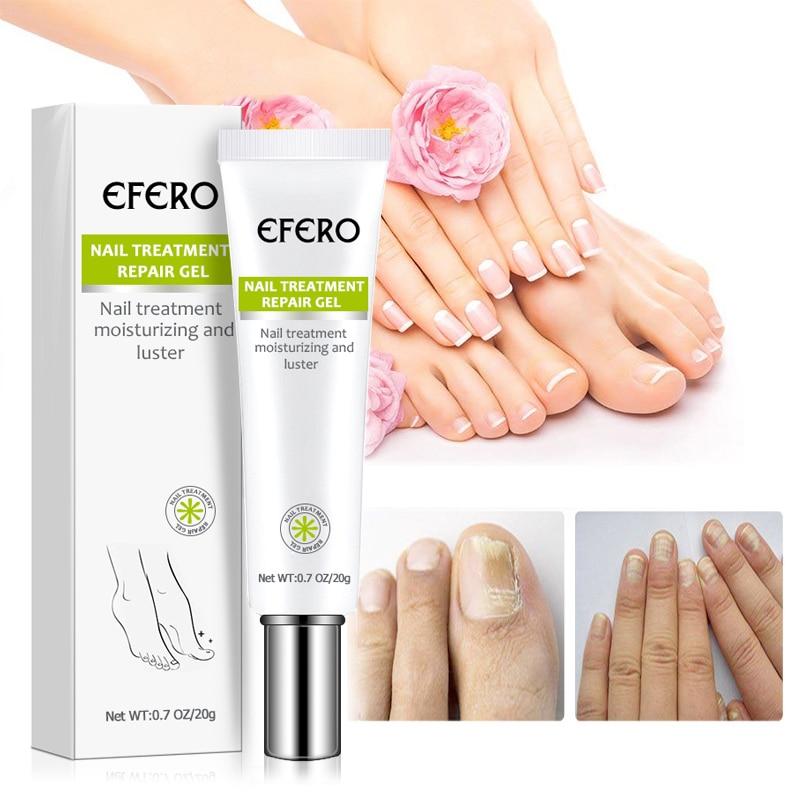 (1+1 free) Fung out™ Nail Treatment Gel