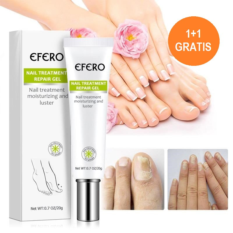 (1+1 free) Fung out™ Nail Treatment Gel