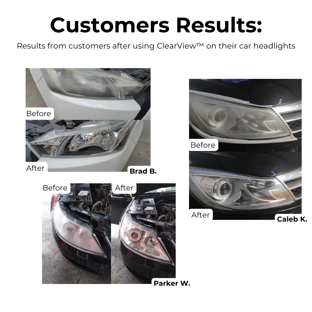 ClearView™ Headlight Repair Fluid | Last Day Buy 1 Get 1 FREE🔥