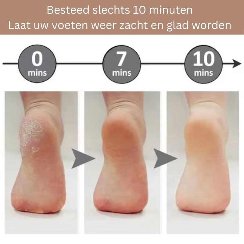 Softride™ — Glide Into Silky, Pain-Free Feet You’ll Proudly Show Off