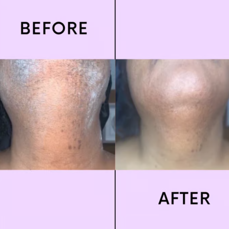 VelvEssence™ — Melt Away Hair Pain-Free for Silky, Confidence-Boosting Smoothness