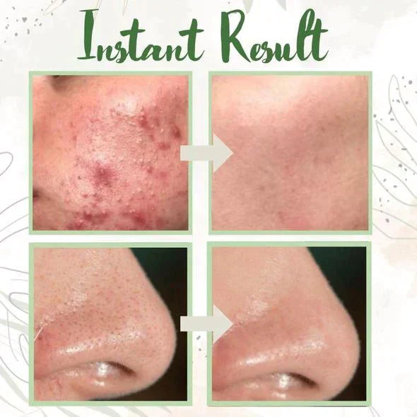 RadianceBoost™ — Unleash Your Skin’s Pure, Glowing Confidence Every Day