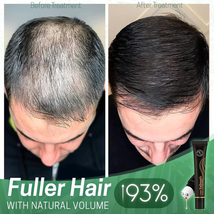 ViraCrest™ — Transform Your Thinning Hair Into a Lush, Head-Turning Crown