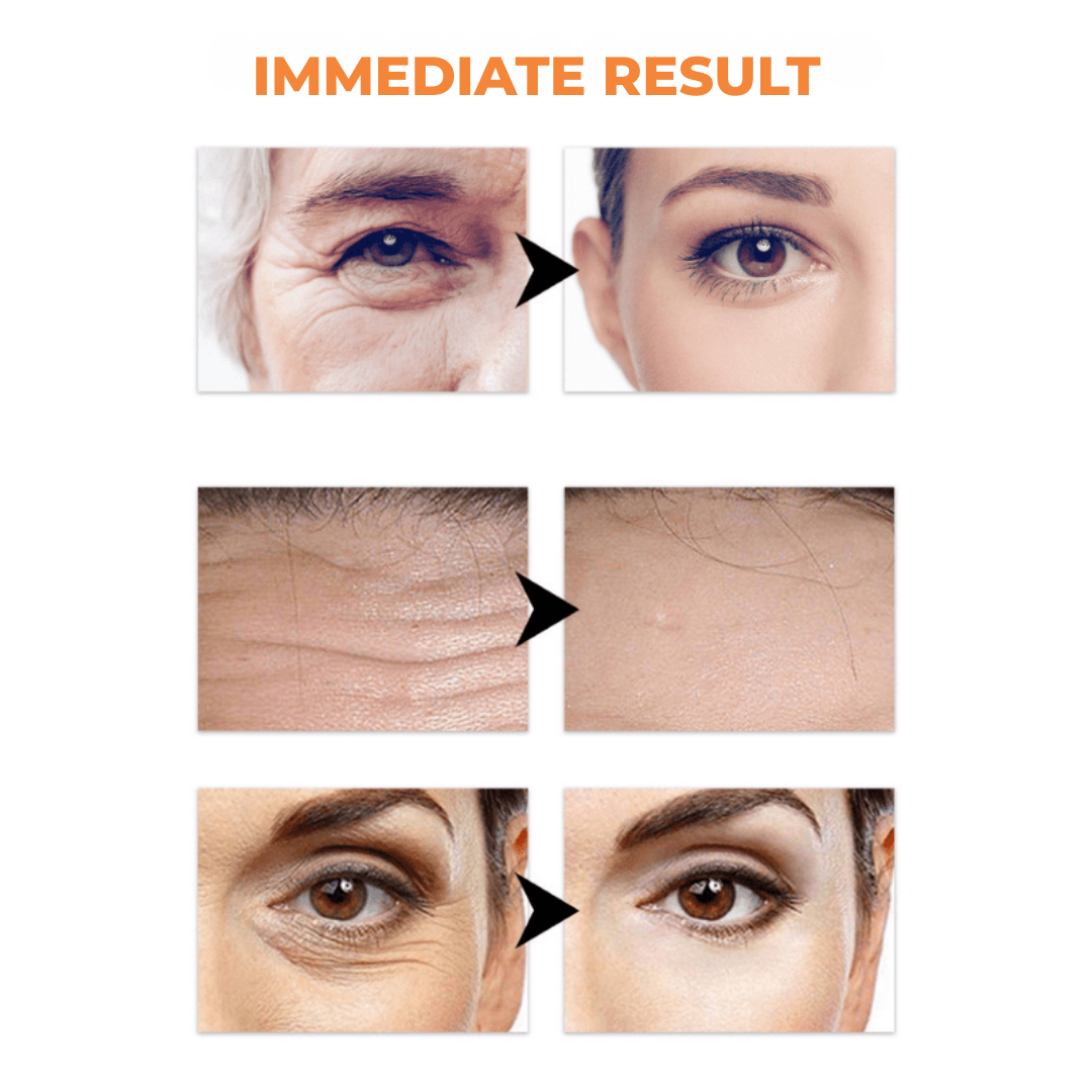VivaLift™ — Instantly Renew Your Skin’s Bounce and Youthful Glow