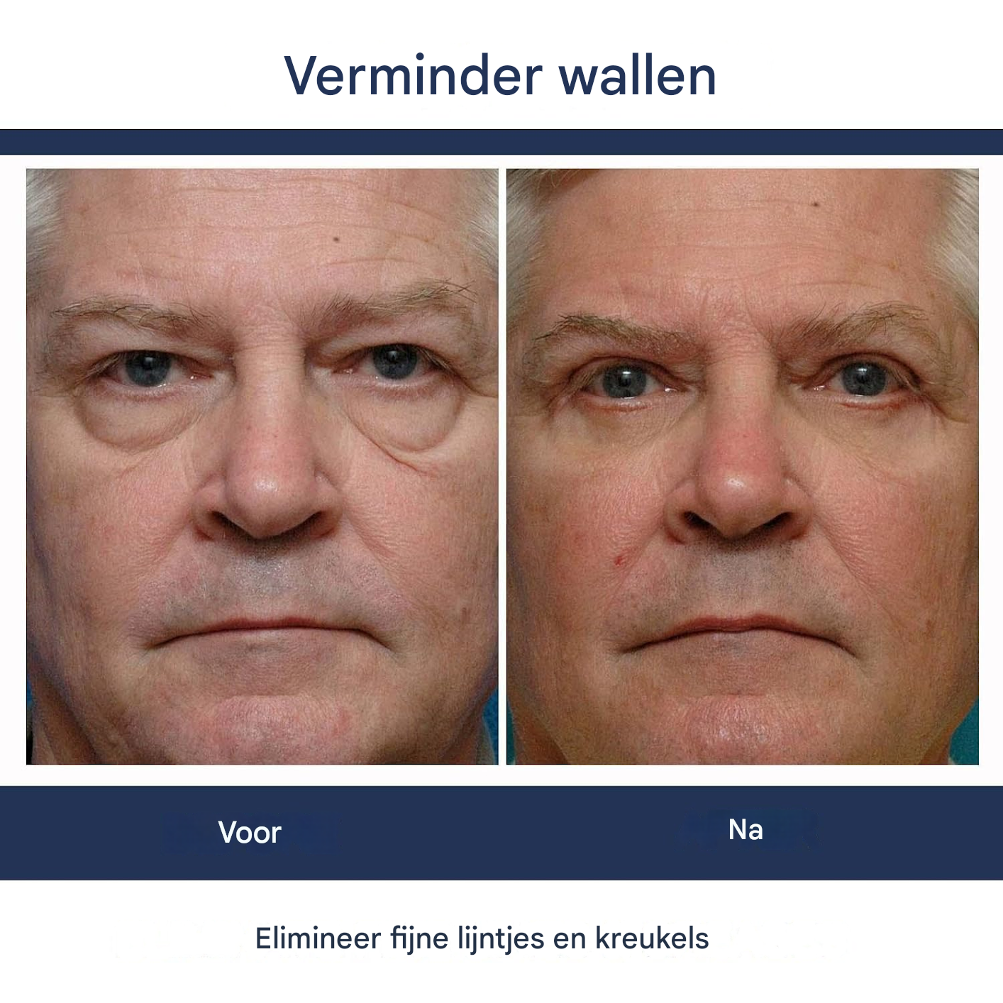 RaminaLift™ — Revive Your Eyes with Youthful Radiance and Lasting Brightness