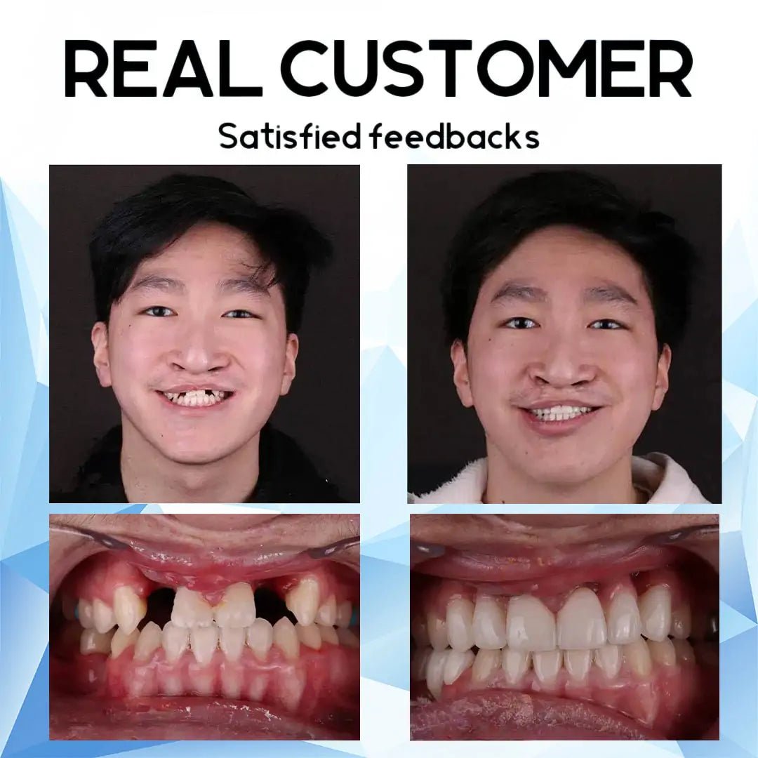 LustraSmile™ — Unlock Unshakable Confidence with Every Pain-Free Smile