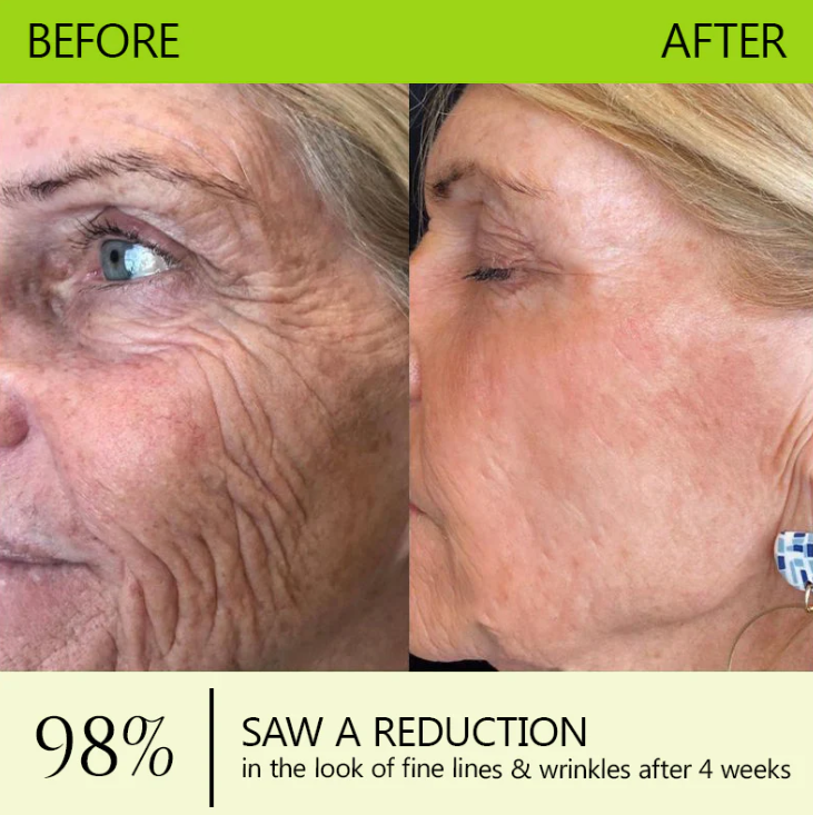 ReviRadiance™ — Unlock Youthful Lift and Radiance Without Needles or Waiting