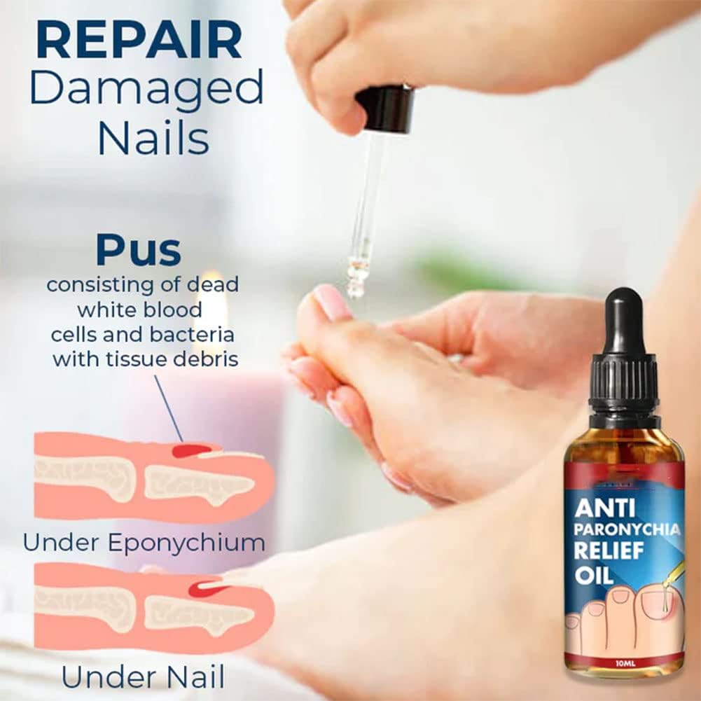 NailCure™ — Unleash Stunningly Strong Nails That Command Attention in Just Weeks