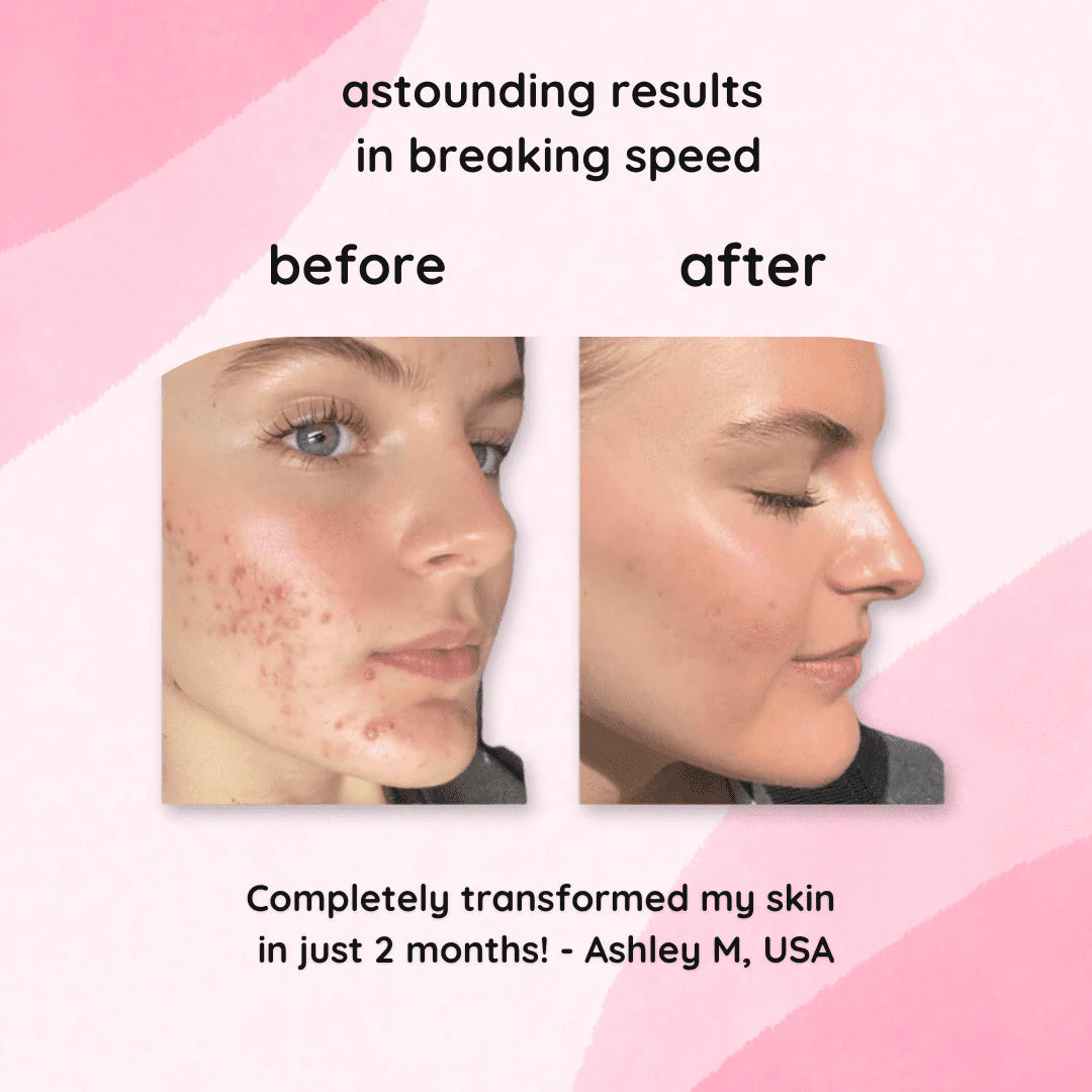 GlowNexa™ — Unleash Your Radiant, Spot-Free Glow Instantly