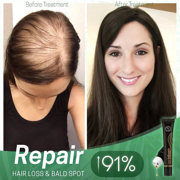 ViraCrest™ — Transform Your Thinning Hair Into a Lush, Head-Turning Crown