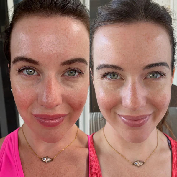 RadianceWave™ — Unlock Radiant, Youthful Skin That Turns Heads Every Time