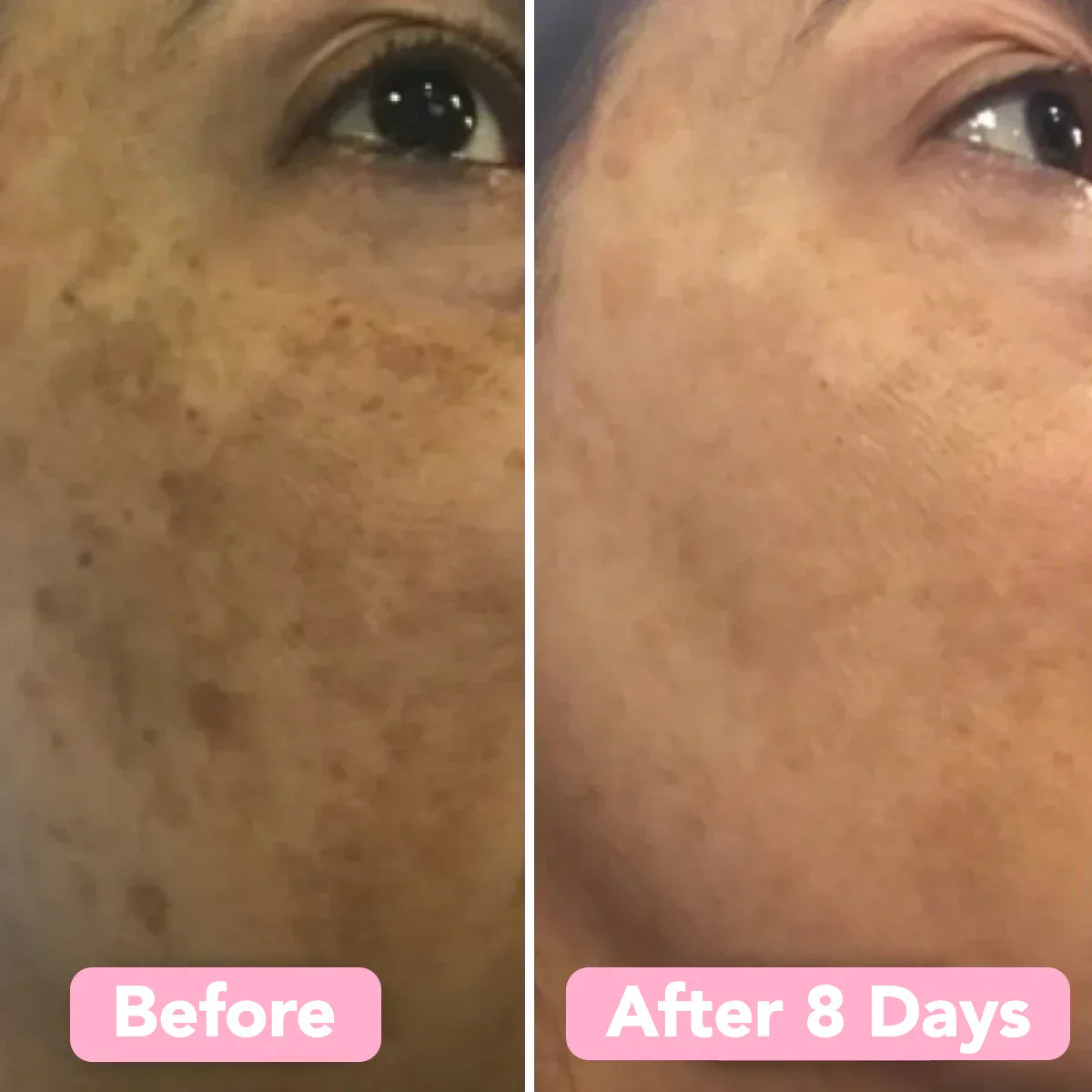 LumiDerm™ — Transform Your Skin with a Radiant, Spot-Free Glow in Just Weeks