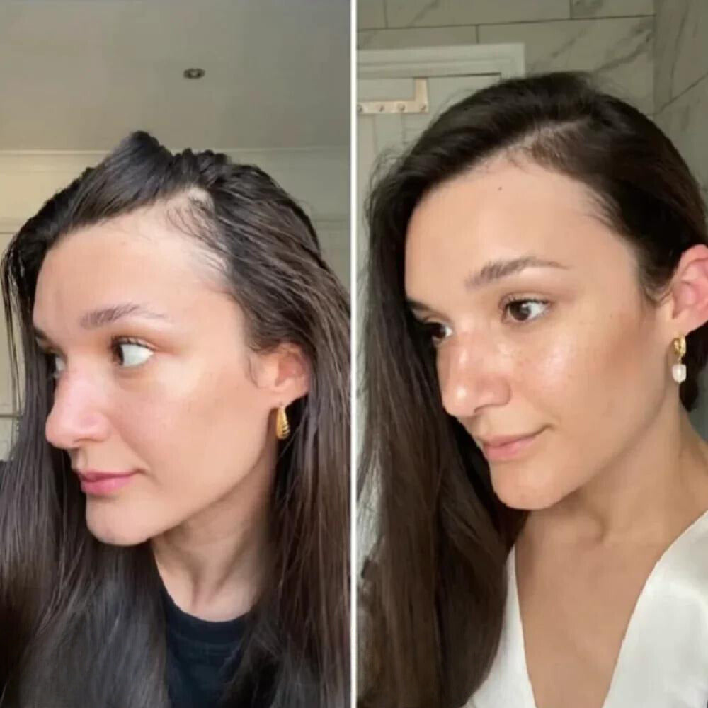 RevitaLeaf™ — Unlock Thick, Lush Hair That Rebuilds Your Confidence