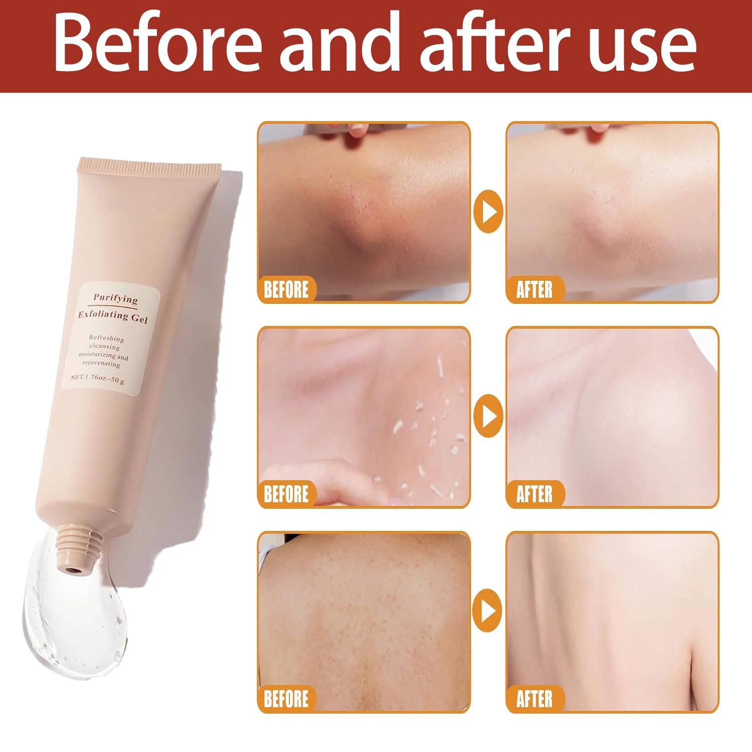 LuminaPure™ Exfoliating Gel — Reveal Baby-Soft, Radiant Skin That Turns Heads Fast