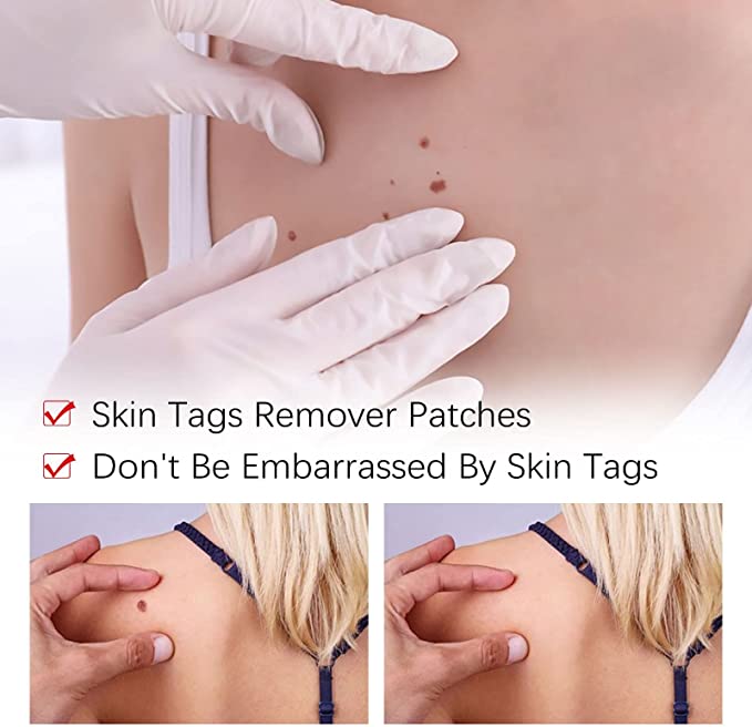 DermaVanish™ — Effortless, Pain-Free Skin Renewal That Restores Your Confidence Fast