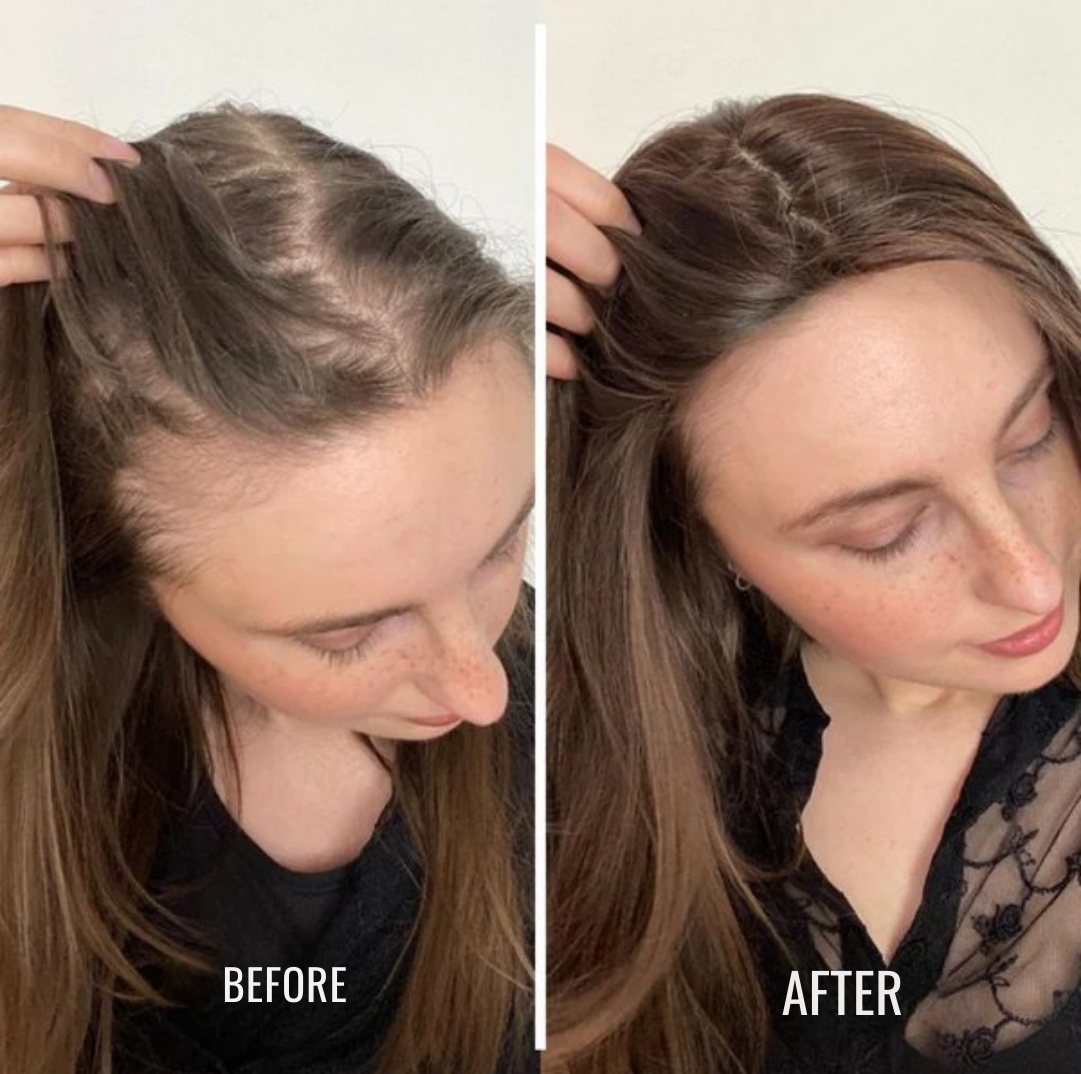 GlowRoot™ Hair Elixir — Awakens Your Scalp to Thicker, Fuller, Irresistible Hair