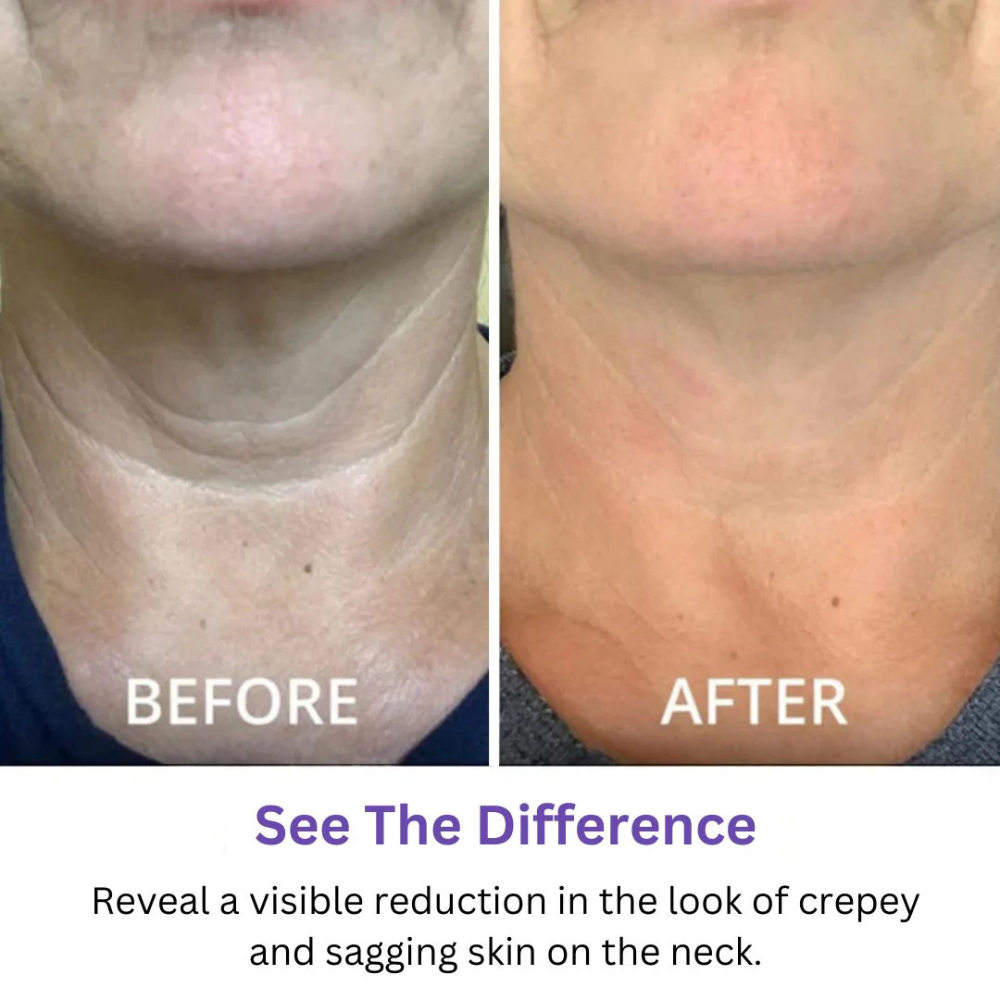 Tighten & Lift Neck Cream | Arvilaro | 1+1 FREE