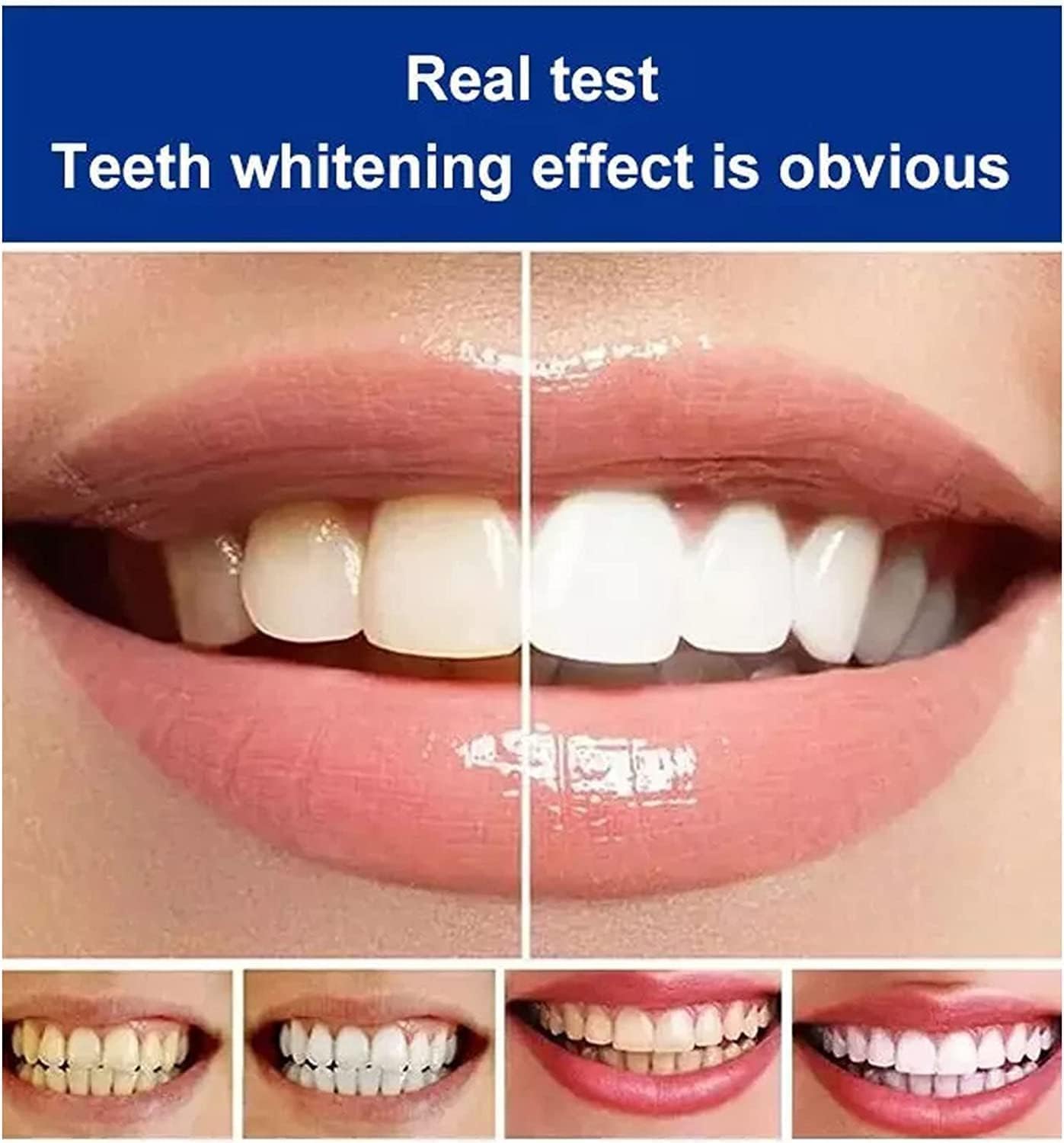 GlowEra™ — Unlock a Radiant Smile That Powers Your Confidence All Day