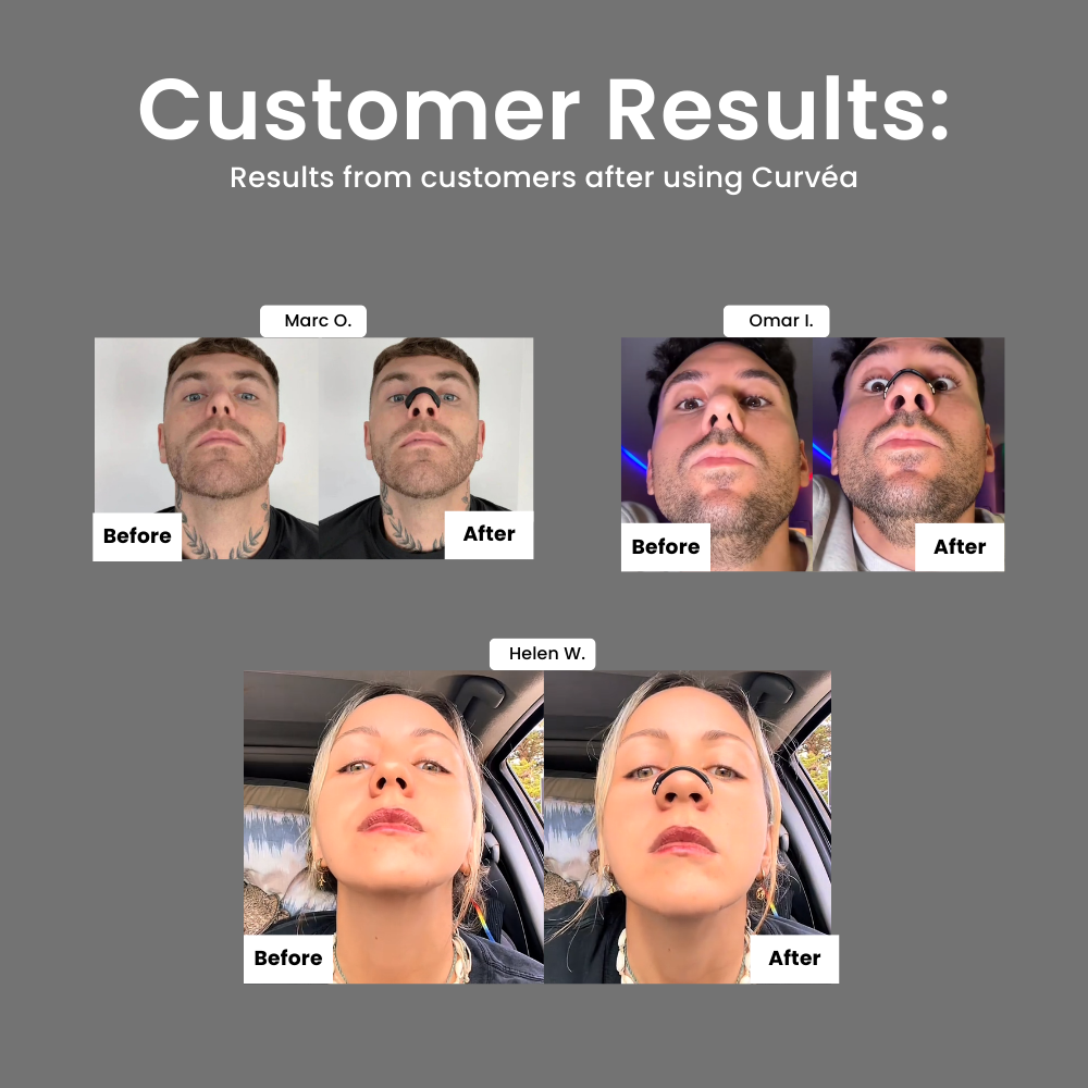 BreathAero™ Nose Strip