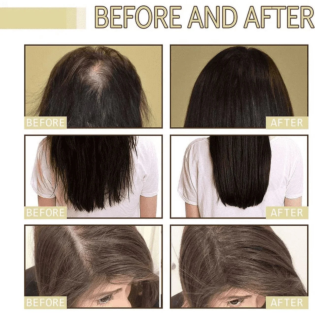 Buy 1 Get 1 FREE | Veganic™ - 100% Natural Vegan Hair Growth Oil