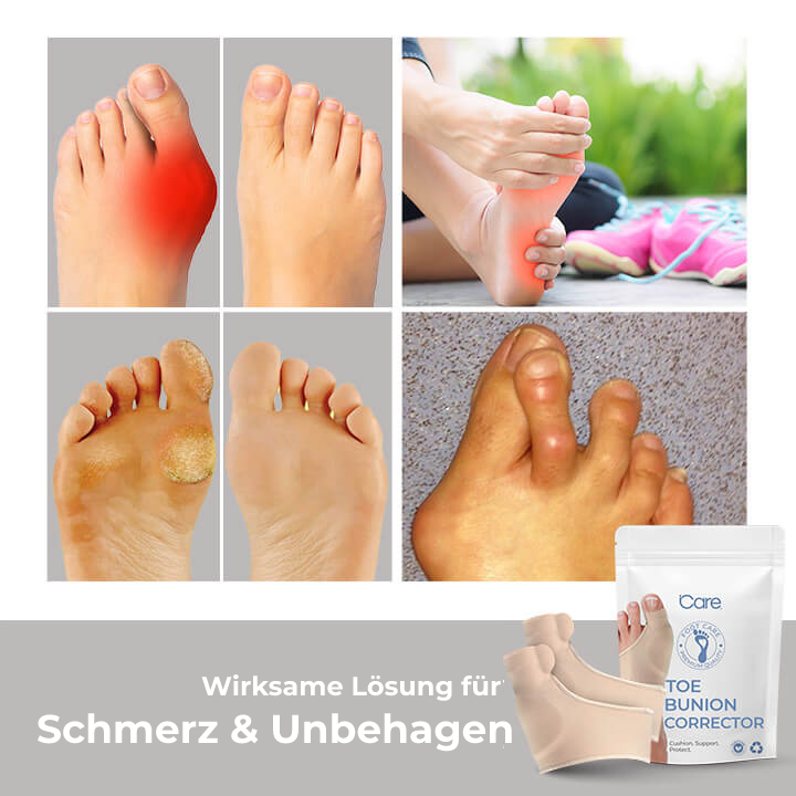 CuraStep™ — Walk Comfortably Again with Pain-Free, Perfectly Aligned Toes