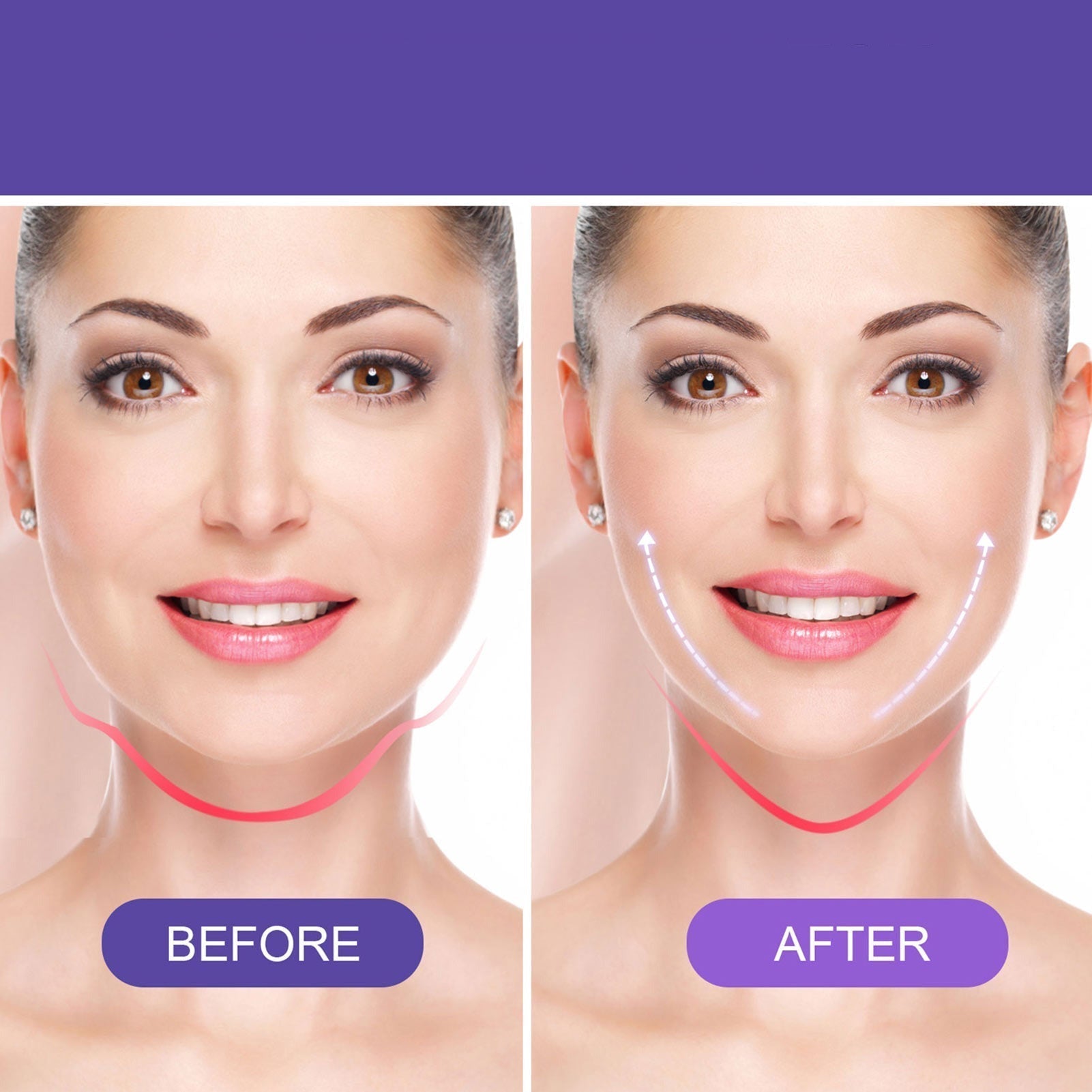 RamellaLift™ — Instantly Sculpt a Youthful, Confidence-Boosting Glow Without Surgery