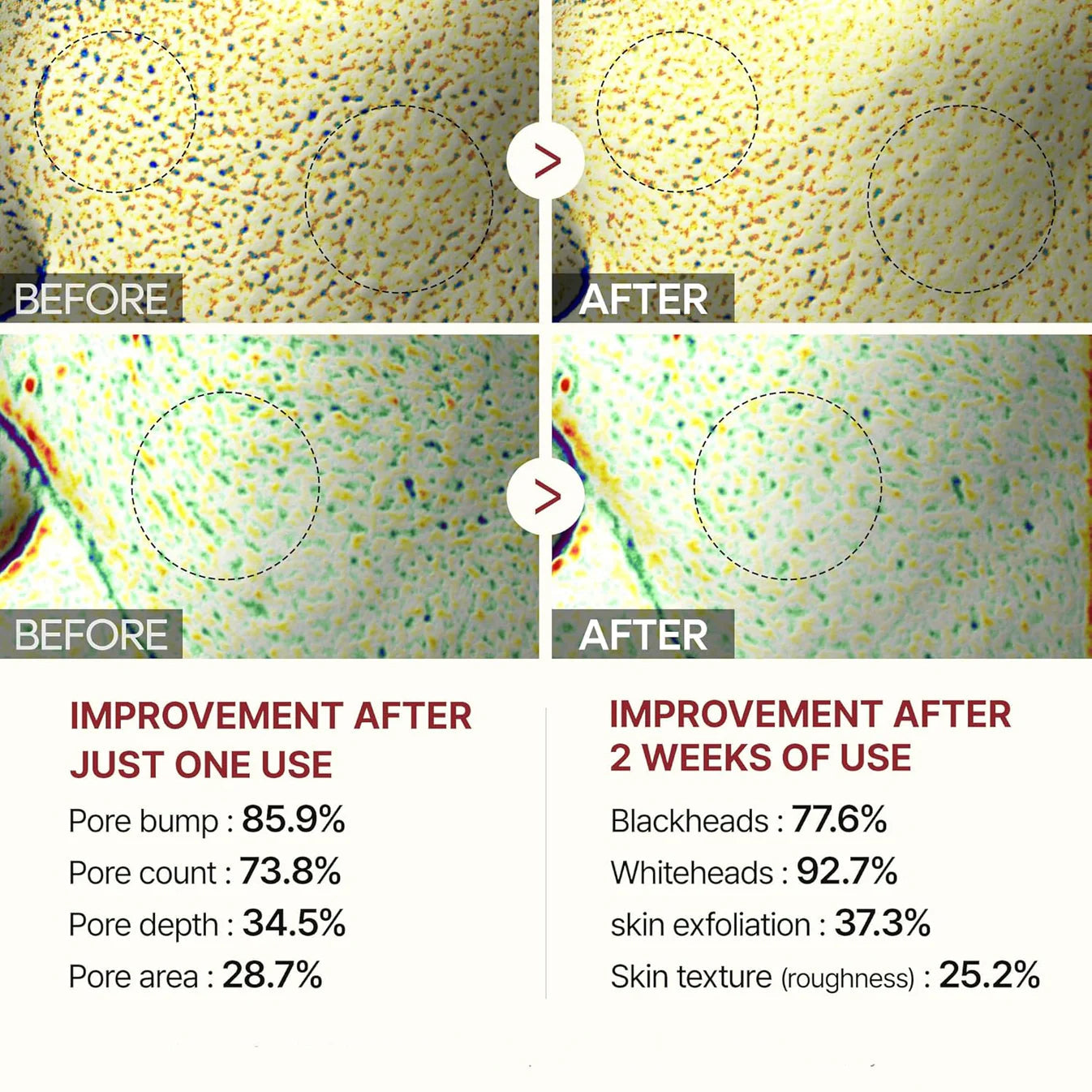 SilkRadiance™ Exfoliant — Glow Fearlessly with Silky, Poreless Skin Every Day