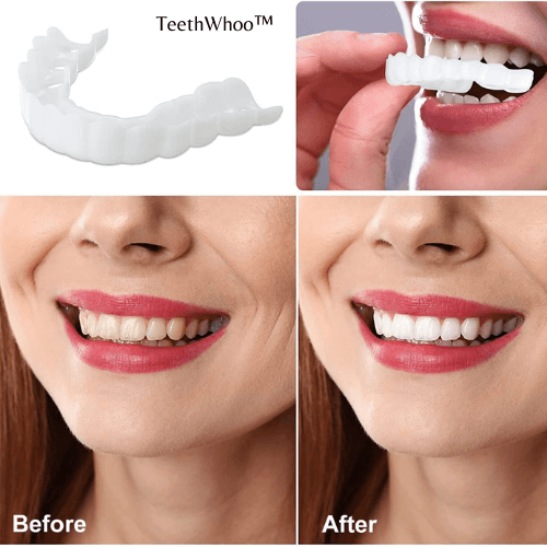 GlimmerSmile™ — Unleash Your Radiant, Confidence-Boosting Smile Instantly