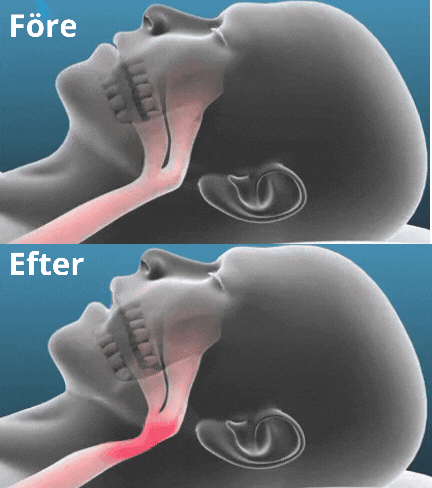 AirPure™ — Quiet Nights That Recharge Your Body and Restore Your Love Life