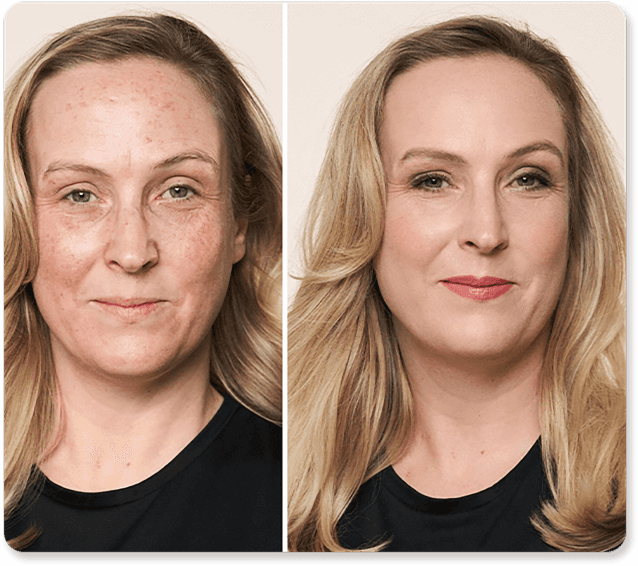 GlowMyst™ Radiance Cream — Unlock Your Effortless, Head-Turning Glow Instantly