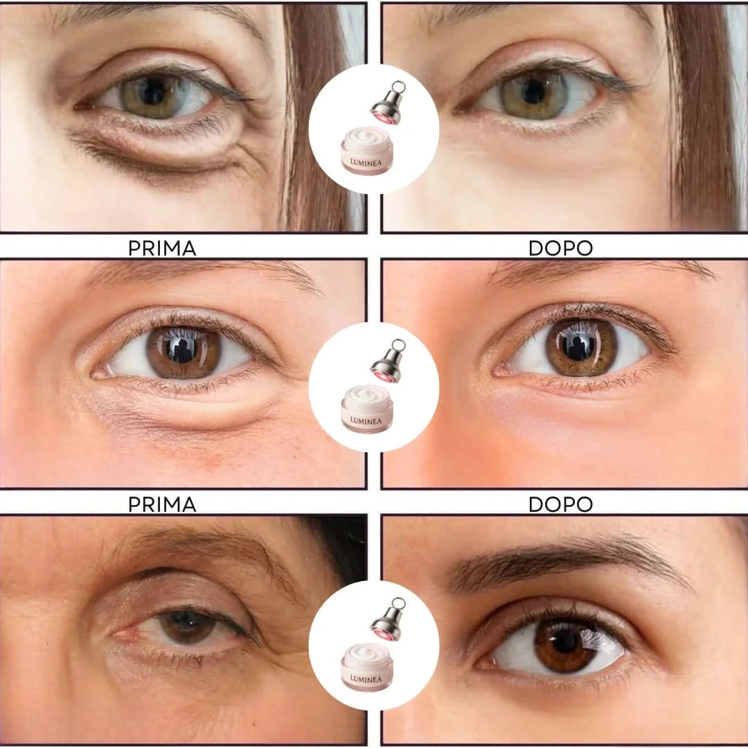 VioraLuxe™ — Revive Tired Eyes Fast for a Brighter, Youthful Glow Every Day