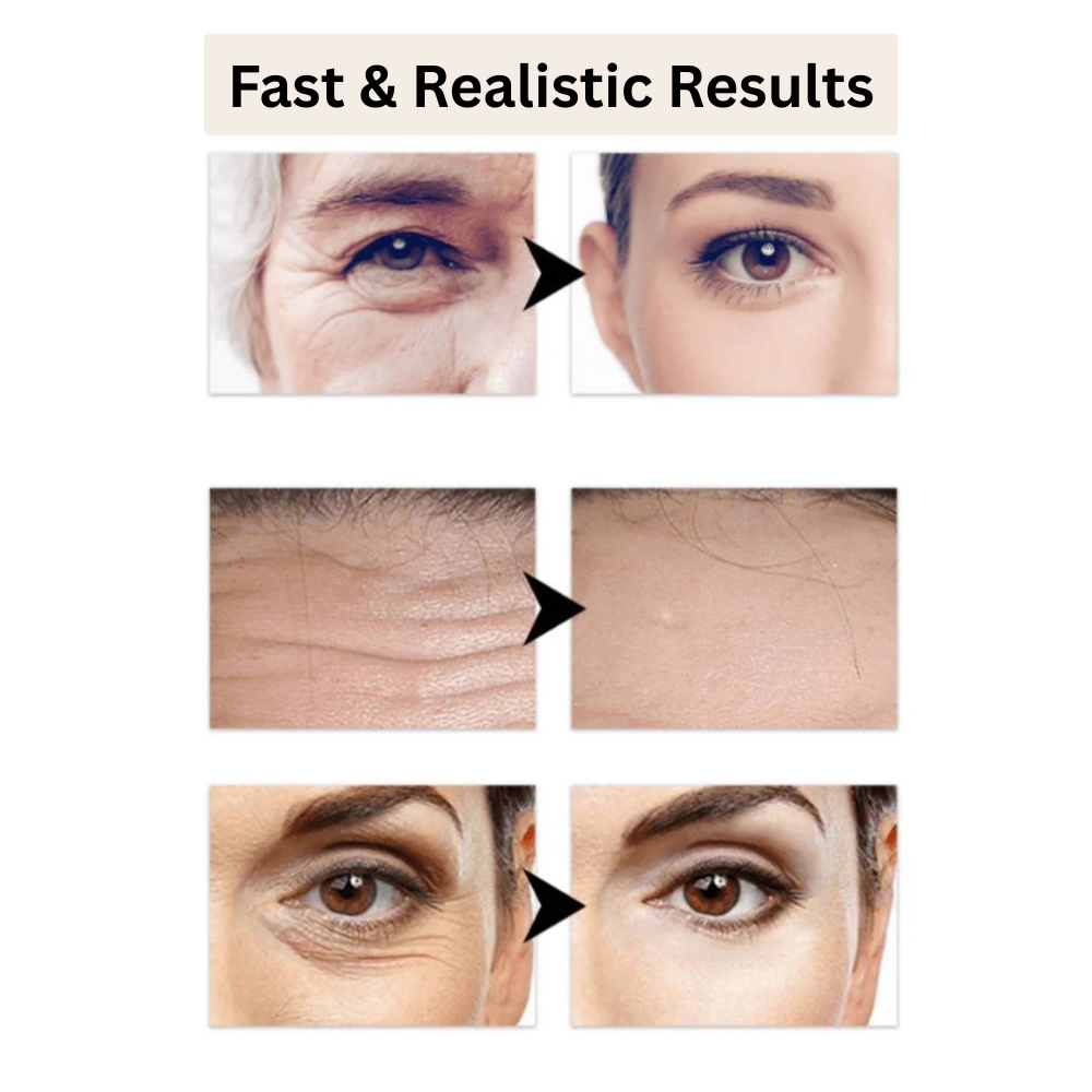PerfectSync™ — Erase Fine Lines & Glow Naturally | 1+1 FREE Today