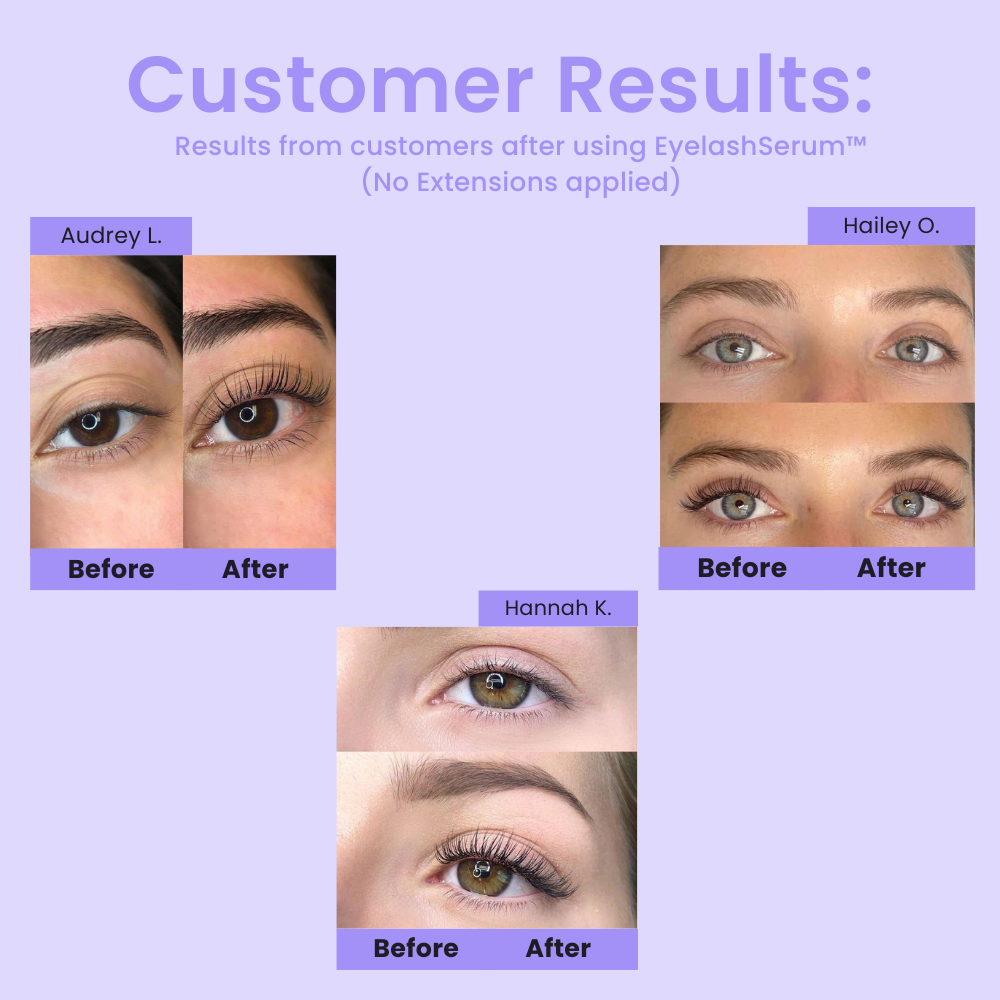 1+1 FREE Eyelash Serum™ - Instant Dream Lashes!