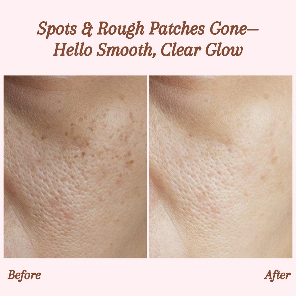RevitaDerm™ — Unleash Radiant, Silky Skin and Banish Flaws for Good