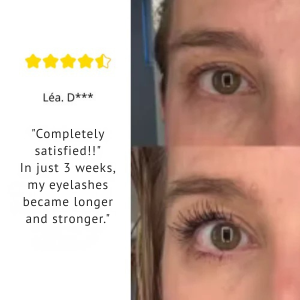 GlowEssentia™ — Unleash Radiant Confidence with Every Glance