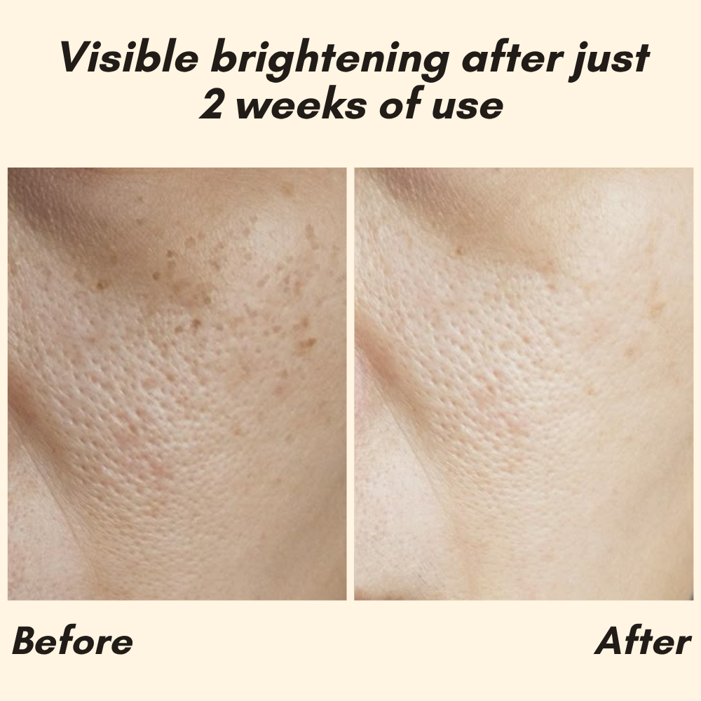 EELHOE Eternity™ — Erase Dark Spots, Reveal Glowing Skin | 1+1 FREE