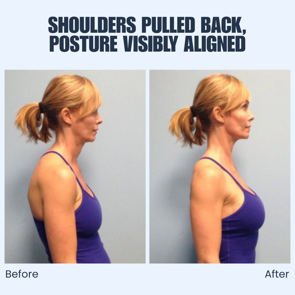 SpineLift™ — Unlock Confident, Pain-Free Posture That Powers Your Day