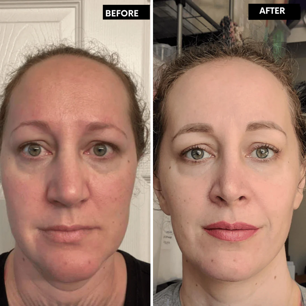 DermaVive™ — Unlock Firm, Radiant Skin That Turns Heads in Just 14 Days