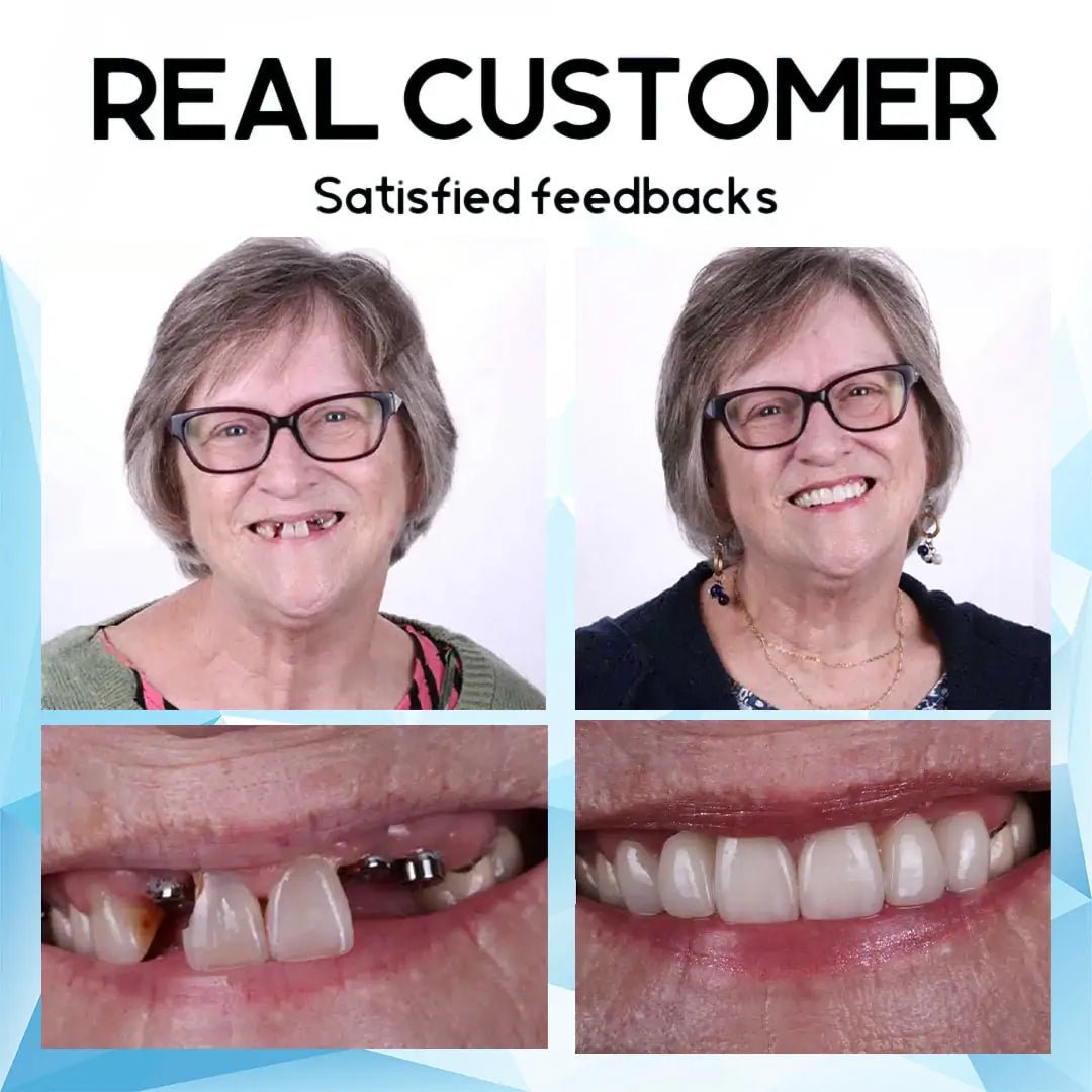 LustraSmile™ — Unlock Unshakable Confidence with Every Pain-Free Smile